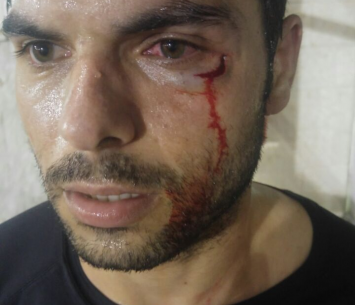 אירוע מכוער ועוד במשחק אימון. איפרגן