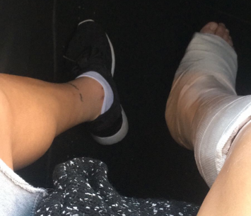 הרגל הפצועה של אלקנתי