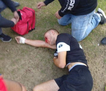 תמונות קשות