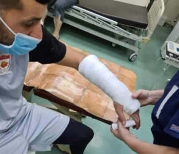 פלזנטל עם הגבס