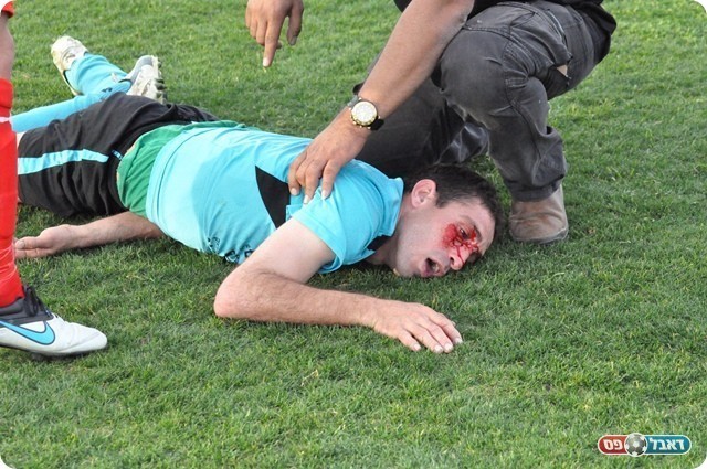 הפציעה (צילום: חאדר אניס)