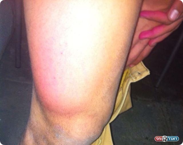 הברך של בוחבוט