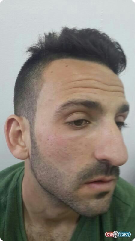 שוקל תביעה אזרחית. גבאי החבול (באדיבות אתר eyoya)