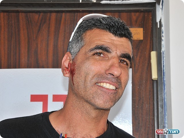 אוהד מגדל העמק שנפצע בסיום המשחק (צילום: ארנון לוי)