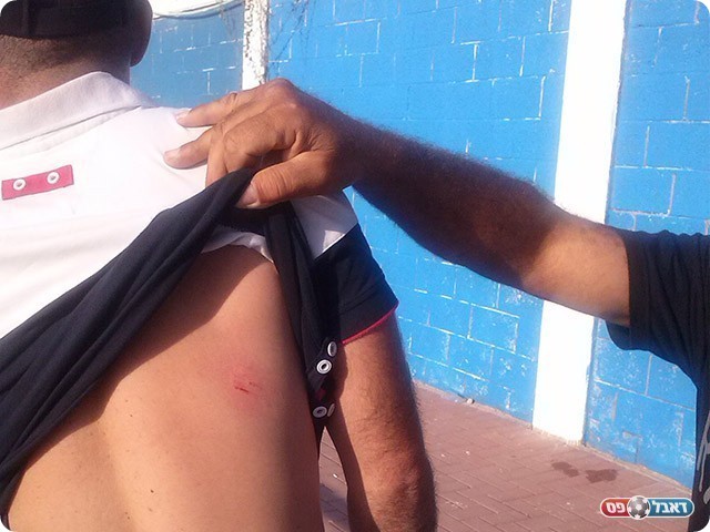 אוהד פגוע מאחד האבנים (ליאור לפוק)