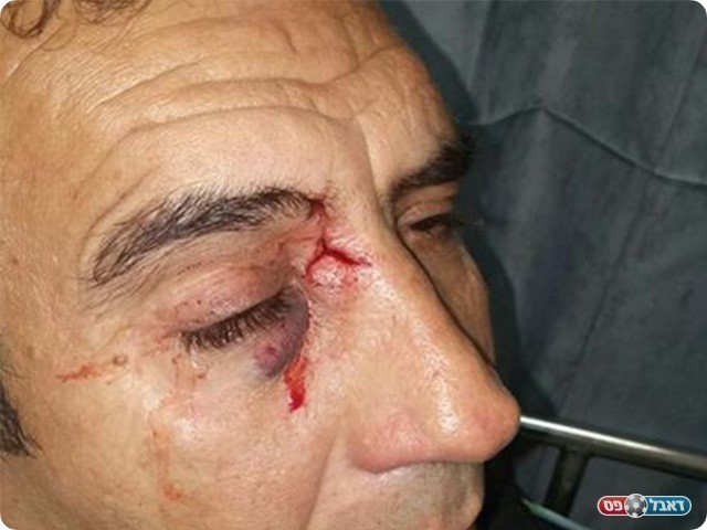 חבר מועצת בית שאן יוסי סוויסה (אולטראס בית שאן)